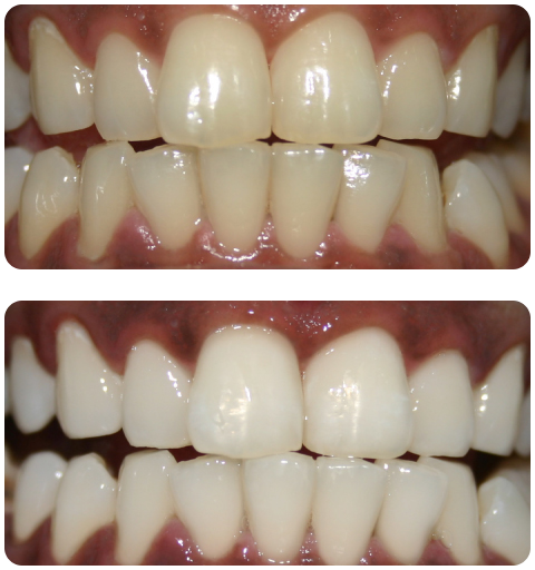 case-2