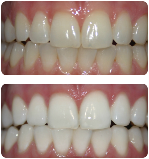 case-6